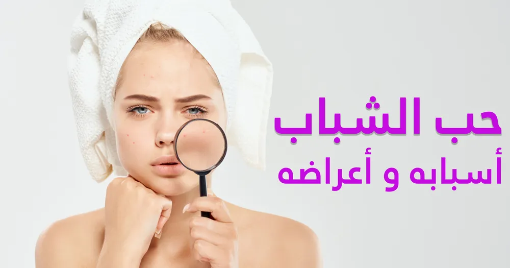 حب الشباب أسبابه و أعراضه